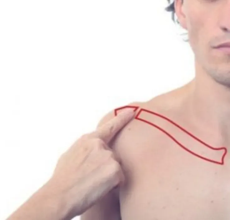 Location of the acromioclavicular joint